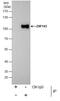 Zinc finger protein 143 antibody, PA5-21448, Invitrogen Antibodies, Immunoprecipitation image 