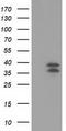 V-Set And Immunoglobulin Domain Containing 2 antibody, TA502124S, Origene, Western Blot image 