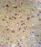 WC1 antibody, 62-284, ProSci, Immunohistochemistry paraffin image 