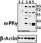 Progestin And AdipoQ Receptor Family Member 5 antibody, GTX66689, GeneTex, Western Blot image 