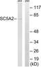 Solute Carrier Family 5 Member 2 antibody, TA314540, Origene, Western Blot image 