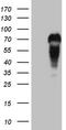 MYCN Proto-Oncogene, BHLH Transcription Factor antibody, LS-C792016, Lifespan Biosciences, Western Blot image 