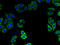 Zinc Finger DHHC-Type Containing 15 antibody, A66718-100, Epigentek, Immunofluorescence image 