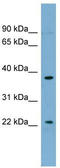 Forkhead Box N4 antibody, TA342522, Origene, Western Blot image 