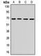 Sorting nexin-18 antibody, orb411733, Biorbyt, Western Blot image 