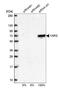 Tyrosyl-TRNA Synthetase antibody, NBP1-86889, Novus Biologicals, Western Blot image 