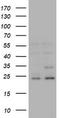 RAB21, Member RAS Oncogene Family antibody, TA505777S, Origene, Western Blot image 