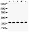 Zinc finger protein SNAI2 antibody, PB9439, Boster Biological Technology, Western Blot image 