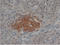 Synaptophysin antibody, SM1461PT, Origene, Immunohistochemistry paraffin image 