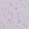 Actin Related Protein T3 antibody, HPA035817, Atlas Antibodies, Immunohistochemistry frozen image 