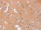 Mitogen-activated protein kinase 11 antibody, CSB-PA657855, Cusabio, Immunohistochemistry paraffin image 