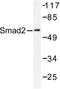 SMAD2 antibody, LS-C176301, Lifespan Biosciences, Western Blot image 