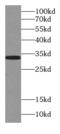 Sulfotransferase 4A1 antibody, FNab08386, FineTest, Western Blot image 