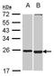 Spermatogenesis And Oogenesis Specific Basic Helix-Loop-Helix 2 antibody, GTX116268, GeneTex, Western Blot image 