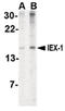 Radiation-inducible immediate-early gene IEX-1 antibody, LS-B1360, Lifespan Biosciences, Western Blot image 