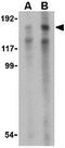 TAR (HIV-1) RNA Binding Protein 1 antibody, GTX85487, GeneTex, Western Blot image 