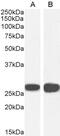 Stratifin antibody, 45-174, ProSci, Western Blot image 