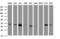 Decapping Enzyme, Scavenger antibody, M02684, Boster Biological Technology, Western Blot image 