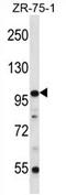 Zinc Finger Protein 845 antibody, AP54730PU-N, Origene, Western Blot image 