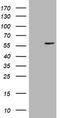 Cytochrome P450 Family 17 Subfamily A Member 1 antibody, CF503435, Origene, Western Blot image 