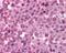 MAGE Family Member A9B antibody, 49-716, ProSci, Immunohistochemistry paraffin image 
