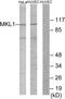 Myocardin Related Transcription Factor A antibody, GTX86986, GeneTex, Western Blot image 