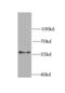 Checkpoint Kinase 1 antibody, FNab01652, FineTest, Western Blot image 