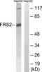 Fibroblast growth factor receptor substrate 2 antibody, TA315112, Origene, Western Blot image 