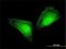 S100 Calcium Binding Protein A11 antibody, H00006282-M01, Novus Biologicals, Immunofluorescence image 