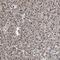 Zinc Fingers And Homeoboxes 2 antibody, HPA006996, Atlas Antibodies, Immunohistochemistry paraffin image 