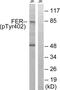 FER Tyrosine Kinase antibody, LS-C198956, Lifespan Biosciences, Western Blot image 