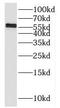 Matrix Metallopeptidase 19 antibody, FNab05237, FineTest, Western Blot image 