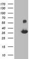 Monoglyceride Lipase antibody, CF502932, Origene, Western Blot image 