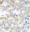Plastin 3 antibody, FNab06558, FineTest, Immunohistochemistry paraffin image 