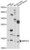 Mitochondrial Ribosomal Protein S33 antibody, LS-C749875, Lifespan Biosciences, Western Blot image 