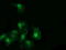 RAB30, Member RAS Oncogene Family antibody, LS-C787535, Lifespan Biosciences, Immunofluorescence image 