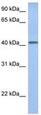 Yip1 Domain Family Member 1 antibody, TA331074, Origene, Western Blot image 