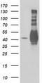 Microtubule Associated Protein RP/EB Family Member 2 antibody, TA502960, Origene, Western Blot image 