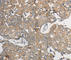 Protein Phosphatase 2 Catalytic Subunit Beta antibody, A3122, ABclonal Technology, Immunohistochemistry paraffin image 