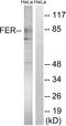 FER Tyrosine Kinase antibody, LS-C118305, Lifespan Biosciences, Western Blot image 