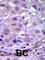 Ret Proto-Oncogene antibody, abx033596, Abbexa, Western Blot image 