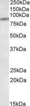 Transporter 1, ATP Binding Cassette Subfamily B Member antibody, STJ71702, St John