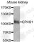 EPH Receptor B1 antibody, A8415, ABclonal Technology, Western Blot image 