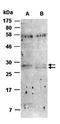 C-C Motif Chemokine Ligand 1 antibody, orb66705, Biorbyt, Western Blot image 