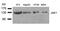 Janus Kinase 1 antibody, GTX50466, GeneTex, Western Blot image 