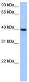 ST6 N-Acetylgalactosaminide Alpha-2,6-Sialyltransferase 4 antibody, TA331001, Origene, Western Blot image 
