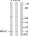 Protein Phosphatase 1 Regulatory Inhibitor Subunit 14C antibody, TA315859, Origene, Western Blot image 