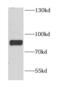 Cytoplasmic dynein 1 intermediate chain 1 antibody, FNab02583, FineTest, Western Blot image 