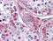 Cathepsin K antibody, TA318065, Origene, Immunohistochemistry paraffin image 