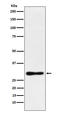 Dimethylarginine Dimethylaminohydrolase 2 antibody, M07566, Boster Biological Technology, Western Blot image 